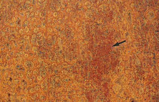 rusting